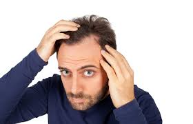 Aloe is an amazing home remedy for hair loss due to a dry or infected scalp. Natural Remedies To Cure Baldness Men S Hair Loss Lyfboat