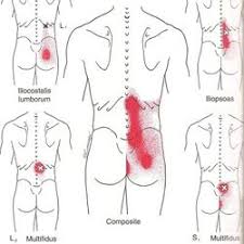 Pin Op Lower Back Strain Exercises