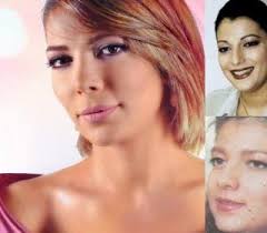 اثارت الاعلامية الكويتية مي العيدان الجدل بعد سخريتها من صورة للفنانة السورية اصالة نصري على طريقة قبل وبعد وذلك عبر حسابها على (انستغرام). Fay3 ØµÙˆØ± ÙÙ†Ø§Ù†Ø§Øª Ø¹Ø±Ø¨ÙŠØ§Øª Ù‚Ø¨Ù„ ÙˆØ¨Ø¹Ø¯ Ø®Ø¶ÙˆØ¹Ù‡Ù† Ù„Ø¹Ù…Ù„ÙŠØ§Øª ØªØ¬Ù…ÙŠÙ„ Ø§Ù„Ø£Ù†Ù Ø£ØµØ§Ù„Ù‡ Ù†ØµØ±ÙŠ Ù…Ø´Ø§Ù‡ÙŠØ±