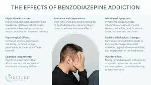 Image result for Benzodiazepine Intoxication