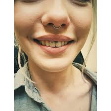 Smiley Piercing