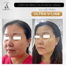 Thẩm mỹ nội khoa TA BEAUTY +