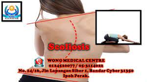 scoliosis rehabilitation in ipoh scoliosis treatment scoliosis rehabilitation