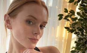 The 5 Best Exfoliants for Sensitive Skin