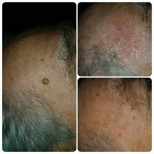 park grange skin (@In2skinn)