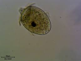In streams and rivers, little to no phytoplankton. John S Mead Pa Twitter Went In To Explore The Pond Water Zoo My Ss Are Maintaining And Was Pleased To Find Living Didinium In The Sample After 3 Weeks Video To
