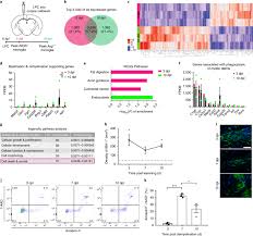 Amy miron, 44 phoenix, az. Central Nervous System Regeneration Is Driven By Microglia Necroptosis And Repopulation Nature Neuroscience