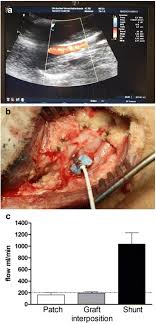 Usa.com provides easy to find states, metro areas, counties, cities, zip codes, and area codes information, including population, races, income, housing, school. Sheep Models For Evaluation Of Novel Patch And Prosthesis Material In Vascular Surgery Tips And Tricks To Avoid Possible Pitfalls Acta Veterinaria Scandinavica Full Text