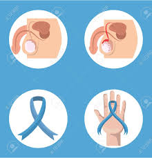 If so, which ones seem to have worked? Set Of Prostate Cancer Symbols Vector Illustration Graphic Design Royalty Free Cliparts Vectors And Stock Illustration Image 112632012