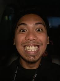 flex ko lang ngipin ko guys. Dati takot na ako pumunta sa mga dentista  dahil sa mga past experiences ko na kahit cleaning lang e masakit na at  umaaraguy ako ng huhubells.