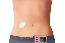 Des courriers ont été adressés au président de la république, au premier ministre, au ministre de la. Quelle Place Pour La Pompe A Insuline Dans Le Diabete De Type 2 Diabetologie Pratique