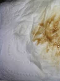 Breakthrough bleeding is vaginal bleeding that occurs between a woman's normal periods generally due to the i have a problem with breakthrough bleeding on my pill with watery brown discharge. 7dpo Implantation Bleeding Pic Included Look At Your Own Risk Page 5 Babycenter