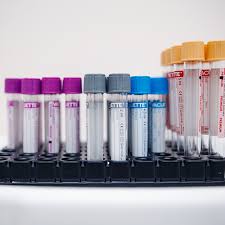 определение пола ребенка по группе крови и резус фактору Opredelenie Gruppy Krovi I Rezus Faktora Neo Slinic Tyumen