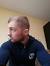 Early Stage Diffuse Balding