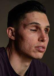 Drew robinson's second act is nothing short of inspiring. Jeff Passan On Twitter I M Meant To Be Alive The Remarkable Story Of Drew Robinson Now At Espn Https T Co Psploh79fu