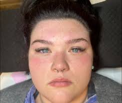 Haley Wiseman, Esthetician...