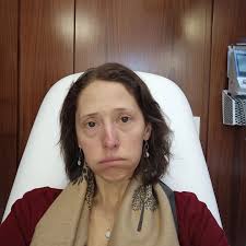 Thank you for all of your prayers and support. The procedure to insert a  stent into my bile duct so that my liver would drain properly didn't work.  My doctor came to