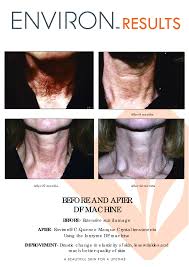 Environ® is a globally recognized and loved professional skincare brand that is built on science, beauty and care. Environ Skin Care Before And After Nuevo Skincare