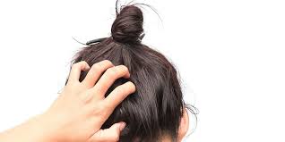 Moreover, an irritated scalp does not support healthy hair growth. Seborrheic Dermatitis Causes And Treatments With Dr Malda