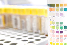 urine analysis colour chart