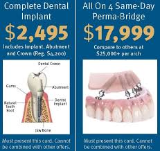 How much should you pay for full mouth dental implants? Costs San Marcos Ca William S Kachele Jr Dmd Associates