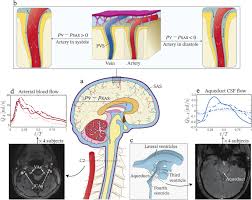 Image result for CSF Blood