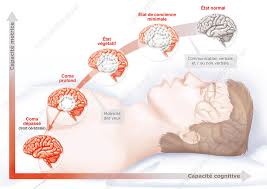 Image result for Coma