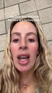 Bridget Mcclain Hit by Hockey Puck