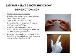Tips On Upper Limb Assessment Median Nerve Nerve Palsy Hand Injuries
