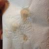 The fluid may be smelly, pinkish, light or dark brown. 1