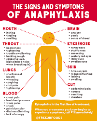 Image result for Anaphylaxis
