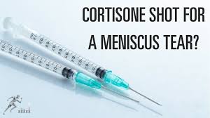 You'll then be positioned so that your doctor can easily insert the needle. Does A Cortisone Shot Help A Meniscus Tear Youtube