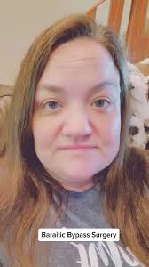 #baratricsurgery #baraitricjourney #baratricpatient I'm pushing through for  great results!!