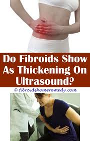 Decaffeinated Green Tea And Fibroids Fibroid Diet Fibroid