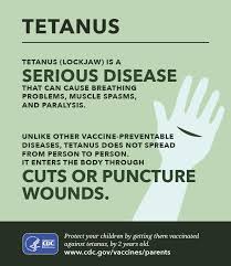 Image result for Tetanus
