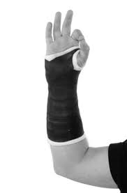 Image result for Short Arm Cast