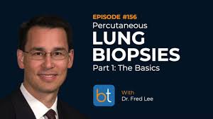 Percutaneous Lung Biopsies: The Basics w/ Dr. Fred Lee