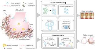 Frontiers Interstitial Lung Disease In Patients With Systemic Sclerosis Toward Personalized Medicine Based Prediction And Drug Screening Models Of Systemic Sclerosis Related Interstitial Lung Disease Ssc Ild Immunology