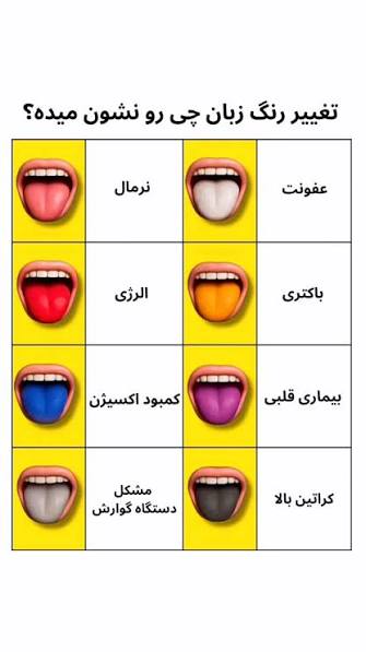 رنگ زبان سالم به رنگ صورتی و پوششی سفید رنگ است. اما این تغییر رنگ از صورتی  به قرمز و مخاط براق نشانه عدم وجود کافی ویتامین B12 و آهن در بدن است. کمبود  این ویتامین‌ها به مراتب باعث صاف شدن سطح زبان و ...