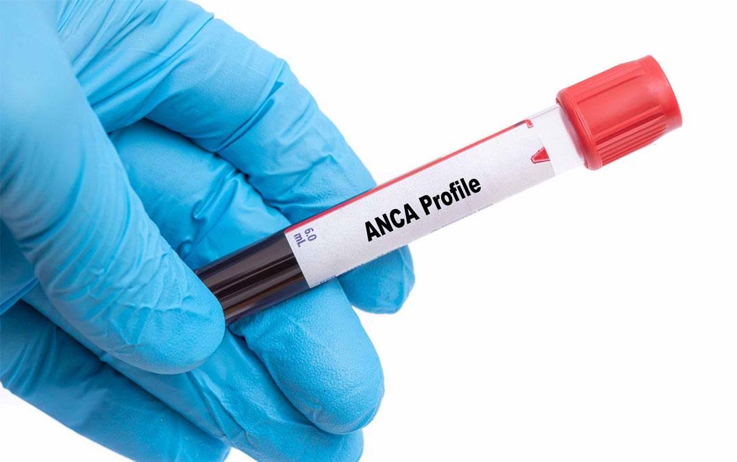 ANA PROFILE product image
