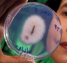 Fusarium Oxysporum Es Una Especie De Hongo Causante De La Enfermedad De Panama En Los Bananeros Y De Mas Disenos De Unas Especies Vegetales Recetas De Bebidas