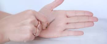 Most people are not actually allergic to gold, but to nickel that is added to gold to make it more suitable for wearing as jewelry. What You Should Know About Gold Allergies