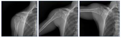Image result for Shoulder Imaging