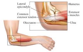 Lifting light objects can also become painful. Common Issues In General Practice Tennis Elbow Glen Iris Medical Group