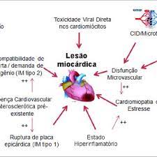 O inverno, as viroses e a miocardite viral. Pdf Coronavirus Disease 2019 And The Myocardium