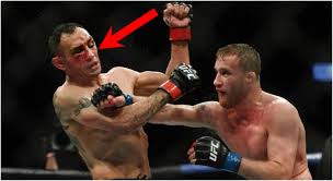 Justin gaethje responds to dana white & wants khabib first before conor. Tony Ferguson Suffered Serious Injury In Ufc 249 Loss