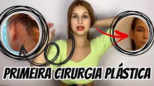 MINHA OTOPLASTIA - YouTube