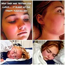 Abbi's Health Update and Support