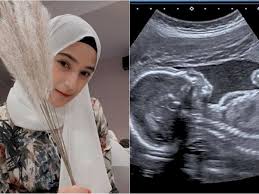 Hal ini kembali menjadi sorotan publik setelah ramainya kabar bahwa ia telah melahirkan anak pertama. Nadya Mustika Rahayu Pamer Foto Usg Alhamdulillah Sehat Sehat Ya Nak Indozone Id