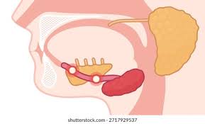 Image result for Sialolithiasis